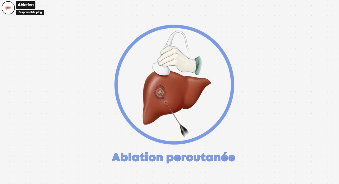 /images/Ablation.png