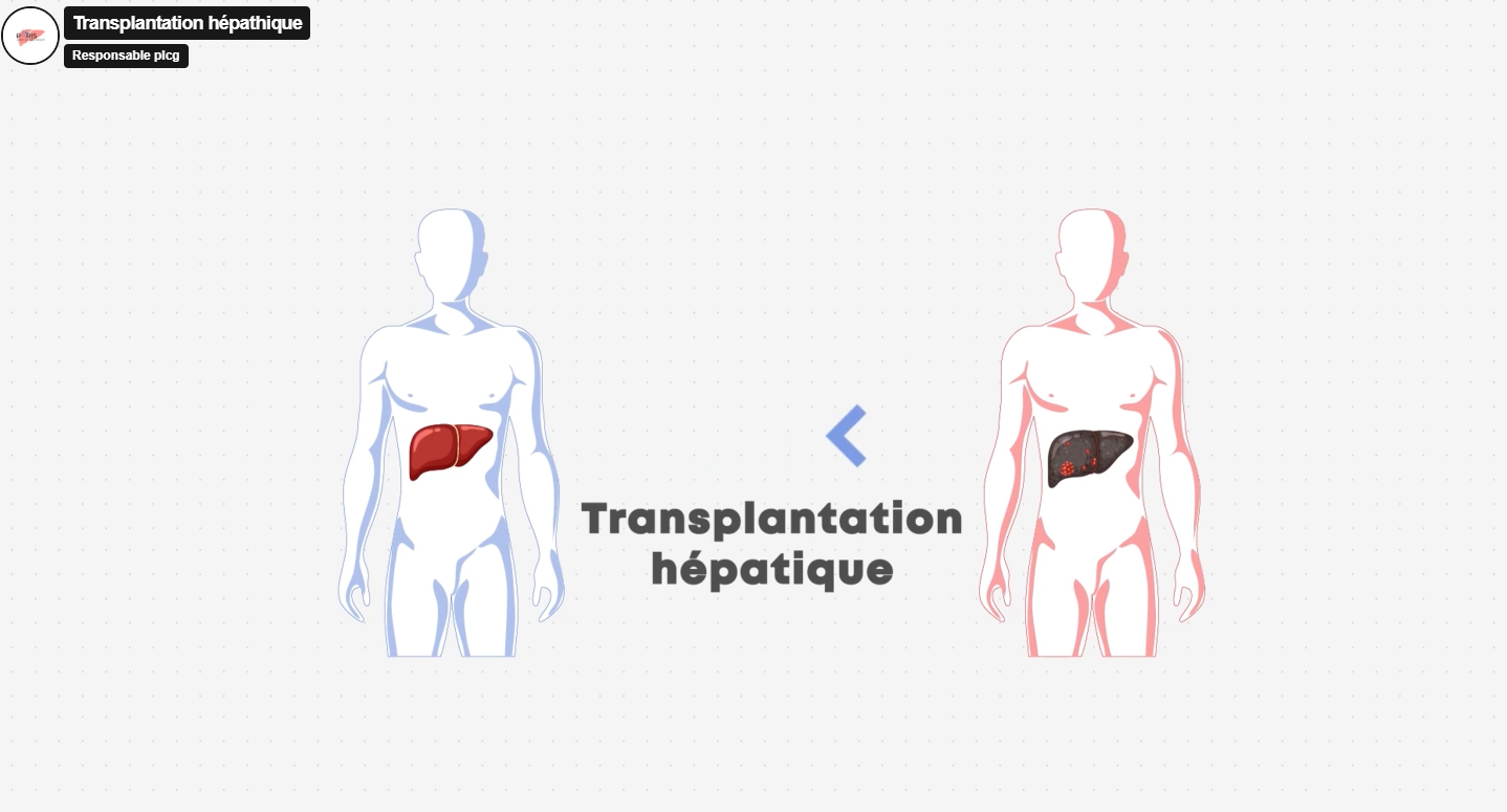 /images/Transplant.png