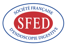 SFED (Société française d'endoscopie digestive)
